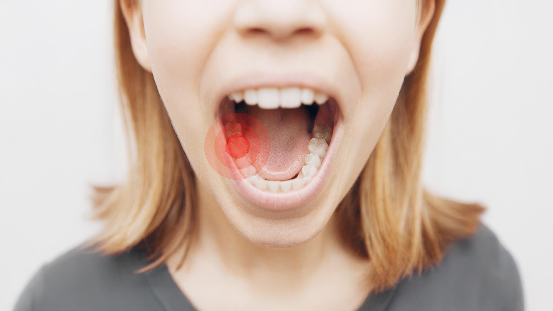 Immagine Parodontologia | MFL | Studio Dentistico Odontoiatrico a Fossalta di Piave VE
