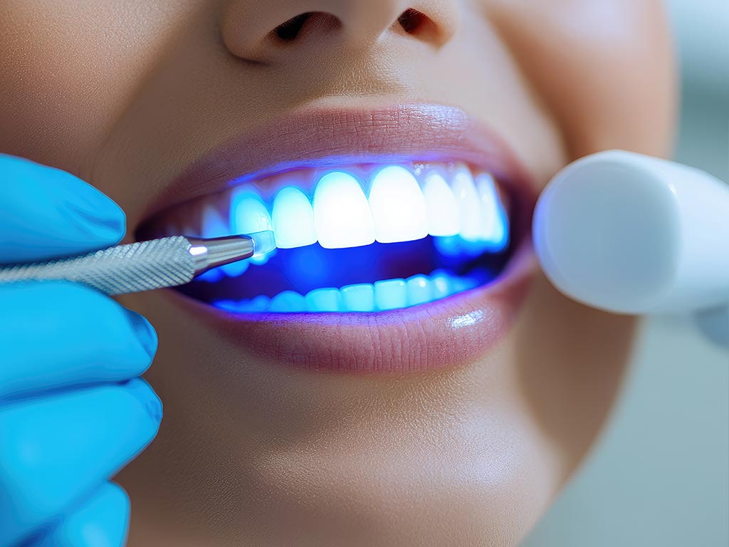 Immagine slider 2 MFL | Studio Dentistico Odontoiatrico a Fossalta di Piave VE